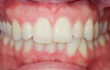 Before